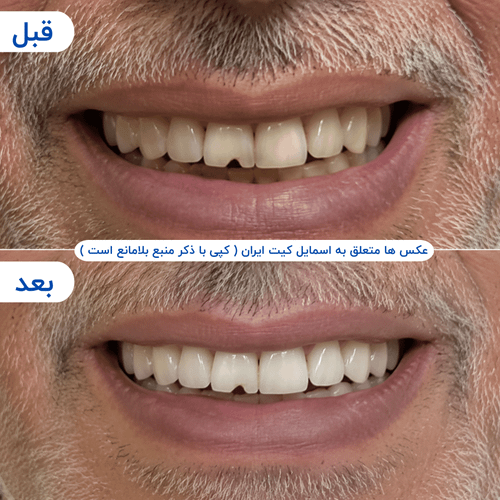 گالری محصول - تصویر ۱
