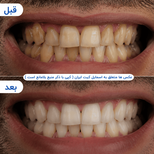 گالری محصول - تصویر ۵