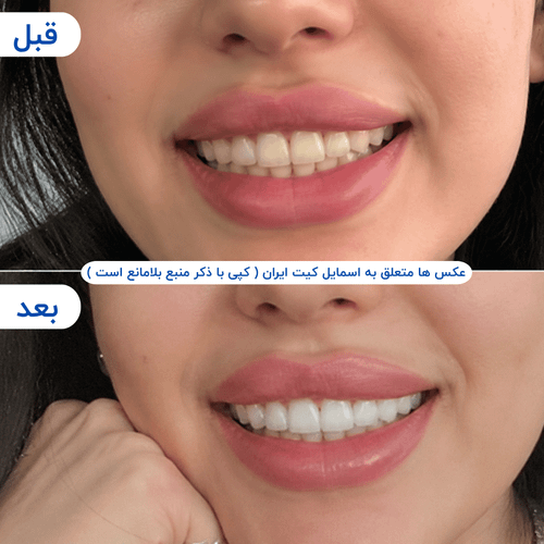 گالری محصول - تصویر ۲