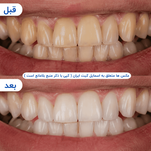 گالری محصول - تصویر ۶