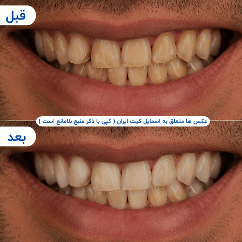 گالری محصول - تصویر ۸