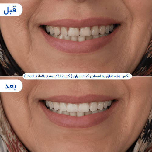 گالری محصول - تصویر ۳