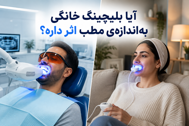 آیا بلیچینگ خانگی بهاندازهی مطب اثر داره؟
