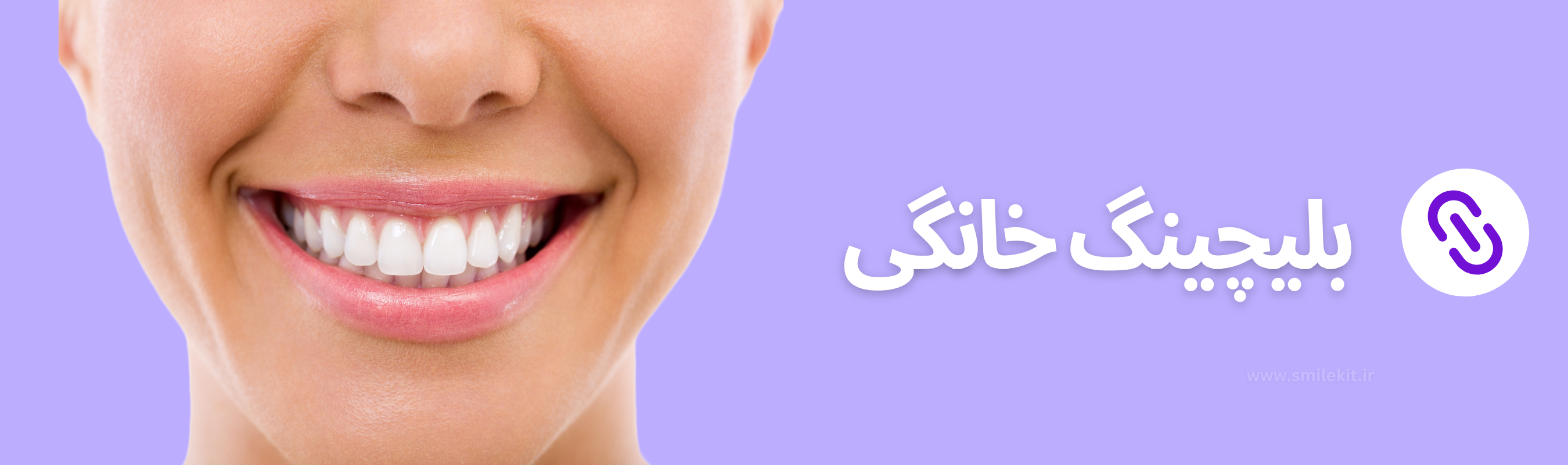 بیلیچینگ خانگی اسمایل کیت هوم بلیچینگ