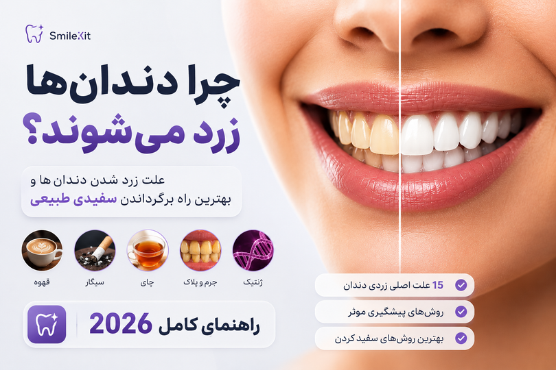 چرا دندانها زرد میشوند؟ ۱۵ علت اصلی زردی دندان + بهترین روش سفید کردن