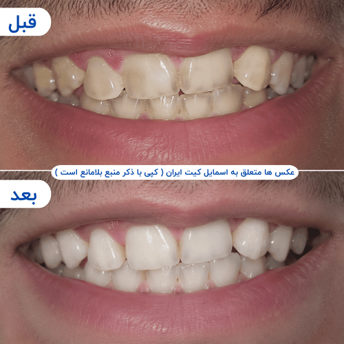 گالری محصول - تصویر ۱۰