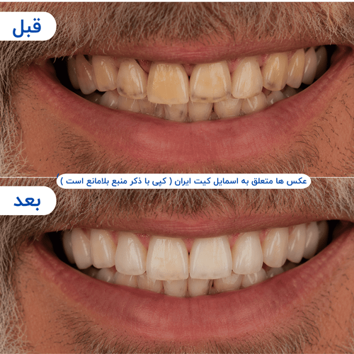 گالری محصول - تصویر ۴
