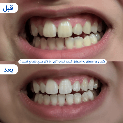 گالری محصول - تصویر ۹