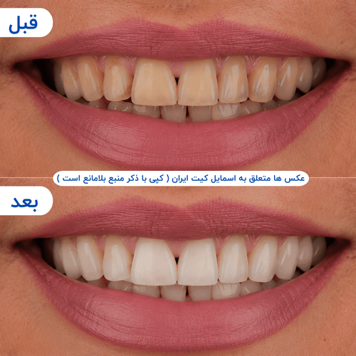 گالری محصول - تصویر ۷