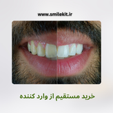 خمیر دندان سفیدکننده گلوری اسمایل ۲۰۲۵