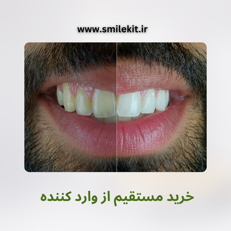 خمیر دندان سفیدکننده گلوری اسمایل ۲۰۲۵